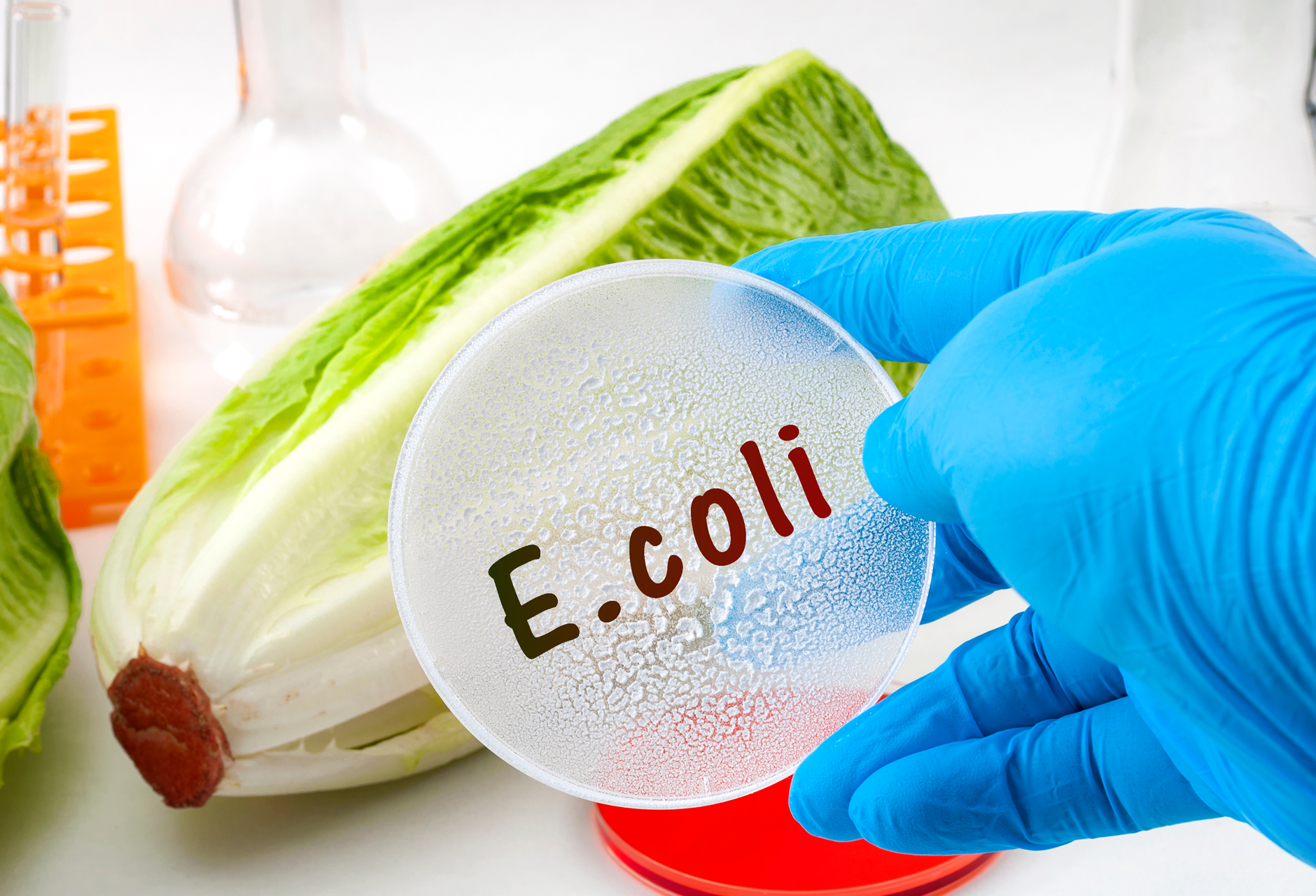 e-coli and petri dish